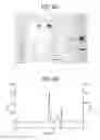 Fig. 15 - Carrier immunoglobulins