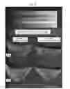 Fig. 07 - Myoglobin-containing food freshness deterioration suppressing material and use thereof