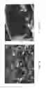 Fig. 09 - Removal of barite weighted mud