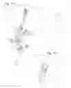 Fig. 05 - ADJUSTABLE HEIGHT HARVEST VALVE ASSEMBLY FOR BIOREACTORS