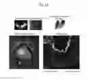 Fig. 24 - Method for preparation of retinal ganglion cells