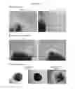 Fig. 33 - Method for preparation of retinal ganglion cells