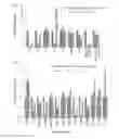 Fig. 05 - A METHOD TO UP-REGULATE CANCER STEM CELL MARKERS FOR THE GENERATION OF ANTIGEN SPECIFIC CYTOTOXIC EFFECTOR T CELLS