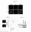 Fig. 06 - METHOD AND CONTAINER FOR CULTURING UNDIFFERENTIATED INDUCED PLURIPOTENT STEM CELL