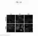 Fig. 11 - METHOD AND CONTAINER FOR CULTURING UNDIFFERENTIATED INDUCED PLURIPOTENT STEM CELL