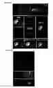 Fig. 34 - PERFORIN 2 DEFENSE AGAINST INVASIVE AND MULTIDRUG RESISTANT PATHOGENS