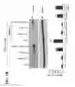 Fig. 05 - Targeting the steroidogenic pathway for treating and/or preventing allergic diseases