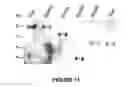 Fig. 19 - Modification of lignin biosynthesis via sense suppression
