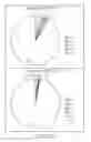 Fig. 24 - Genetically modified microorganism for producing medium-chain lauric acid and/or dodecanedioic acid and method of using thereof