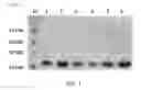 Fig. 02 - Mutant sugar isomerase with improved activity, derived from , and production of L-gulose using the same