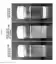Fig. 07 - Bacterial cellulose and bacterium producing it