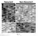 Fig. 04 - Systems and methods for expression-based discrimination of distinct clinical disease states in prostate cancer