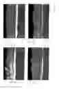 Fig. 08 - Method for producing a component having improved elongation at break properties