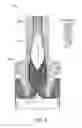Fig. 07 - Seed chuck assemblies and crystal pulling systems for reducing deposit build-up during crystal growth process