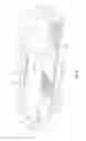 Fig. 05 - Heating device for tumble dryer and tumble dryer