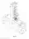 Fig. 13 - Adjustable tension tie