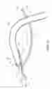 Fig. 10 - Gutter Cleaning Device