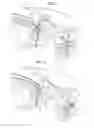 Fig. 05 - Solid propellant rocket motor