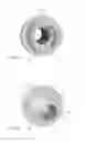 Fig. 04 - Fitting and method of manufacturing a fitting for attaching flexible tube to rigid tube