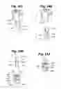 Fig. 17 - Tangle-resistant decorative lighting assembly