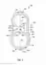 Fig. 04 - Tube thermal coupling assembly