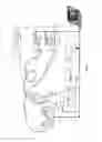 Fig. 06 - Two-channel point-diffraction interferometer