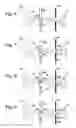 Fig. 05 - Detection and signal processing system for particle assays