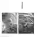 Fig. 03 - System and method for controlling depth of imaging in tissues using fluorescence microscopy under ultraviolet excitation following staining with fluorescing agents
