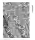 Fig. 04 - System and method for controlling depth of imaging in tissues using fluorescence microscopy under ultraviolet excitation following staining with fluorescing agents