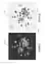 Fig. 15 - System and method for controlling depth of imaging in tissues using fluorescence microscopy under ultraviolet excitation following staining with fluorescing agents