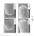 Fig. 14 - DIFFUSION RESISTANCE LAYER FOR ANALYTE SENSORS