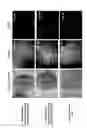 Fig. 07 - Device and method for measuring impedance in organotypic tissues