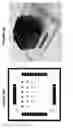 Fig. 09 - Device and method for measuring impedance in organotypic tissues