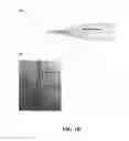 Fig. 03 - Constriction-Expansion Blood Plasma Separation