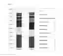 Fig. 02 - Method for diagnostics, treatment and prevention of Parkinson's disease