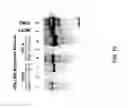 Fig. 17 - 5-ALA FOR DETECTION OF BRAIN TUMORS