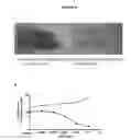Fig. 10 - METHODS OF DIAGNOSING ALS