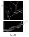 Fig. 16 - Cerebrospinal diffusion phantom