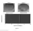 Fig. 05 - Method and system for fracture detection using acoustic waves