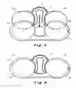 Fig. 05 - Pince-nez