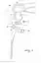 Fig. 04 - Hinge device for eyeglasses