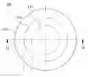 Fig. 01 - Contact lens