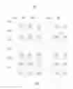 Fig. 02 - Repairing methods of defective pixels having light spots, array substrates and liquid crystal panels