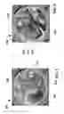 Fig. 06 - Interactive map informational lens
