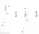 Fig. 06 - Multiple patterning method for semiconductor devices