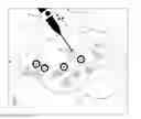 Fig. 01 - Method and system for supporting a medical brain mapping procedure