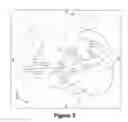 Fig. 03 - Method and system for supporting a medical brain mapping procedure