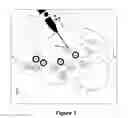 Fig. 04 - Method and system for supporting a medical brain mapping procedure