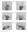 Fig. 01 - Recognition of hand poses by classification using discrete values