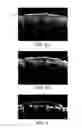 Fig. 05 - Method for evaluating skin tissue and system using the same